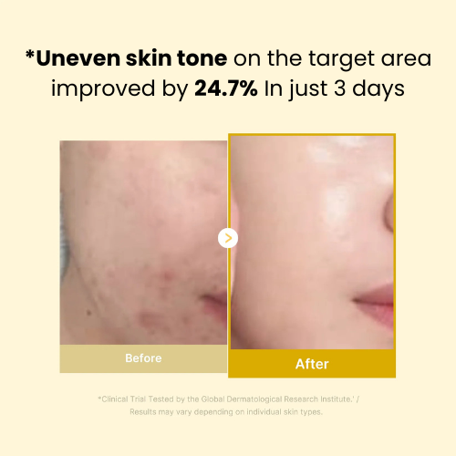 Kojic Acid Turmeric Overnight Mask