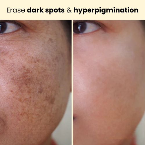 Kojic Acid Turmeric Overnight Mask