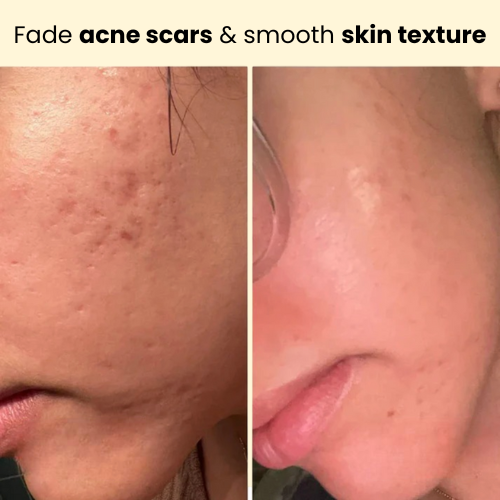 Kojic Acid Turmeric Overnight Mask