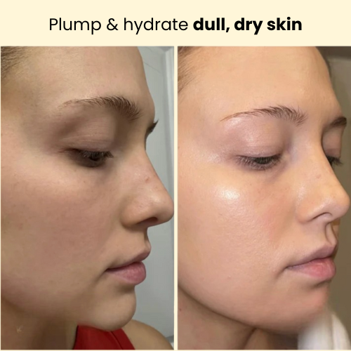 Kojic Acid Turmeric Overnight Mask