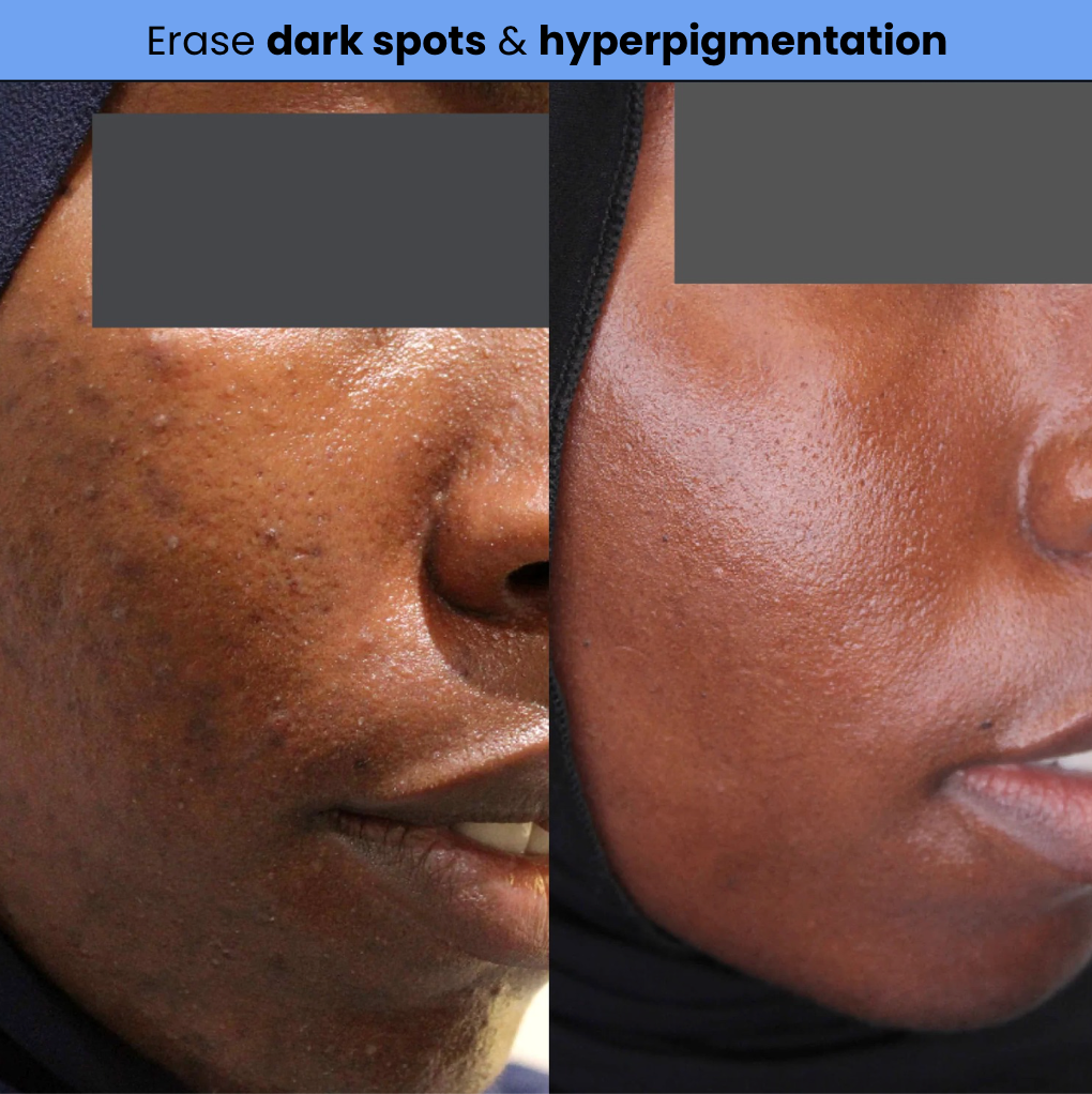 Exosome Shot Serum