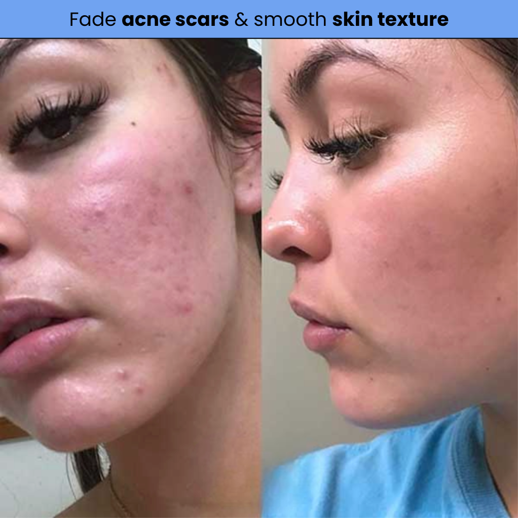 Exosome Shot Serum