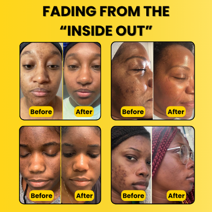 The Inside Out Treatment