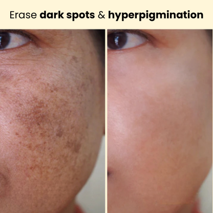 Kojic Acid Turmeric Overnight Mask