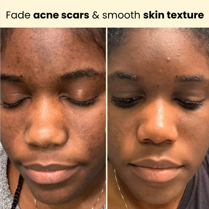 Kojic Acid Turmeric Overnight Mask
