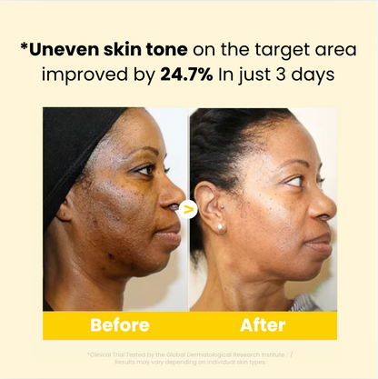 Kojic Acid Turmeric Overnight Mask