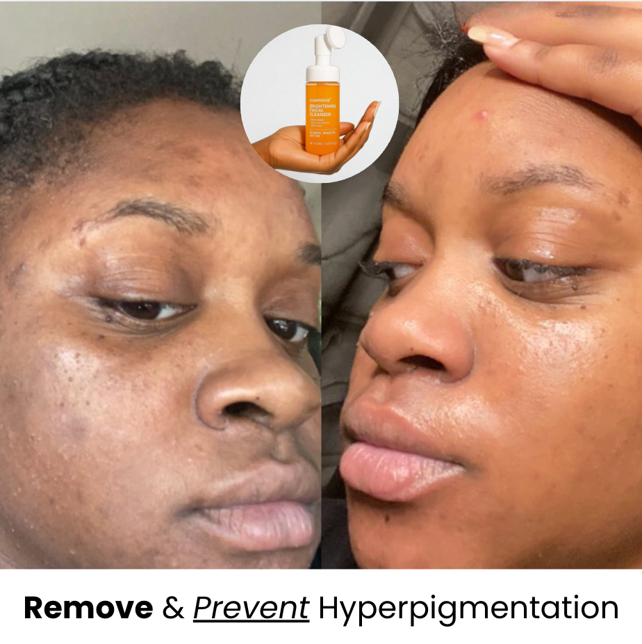 Kojic Acid Turmeric Face Wash