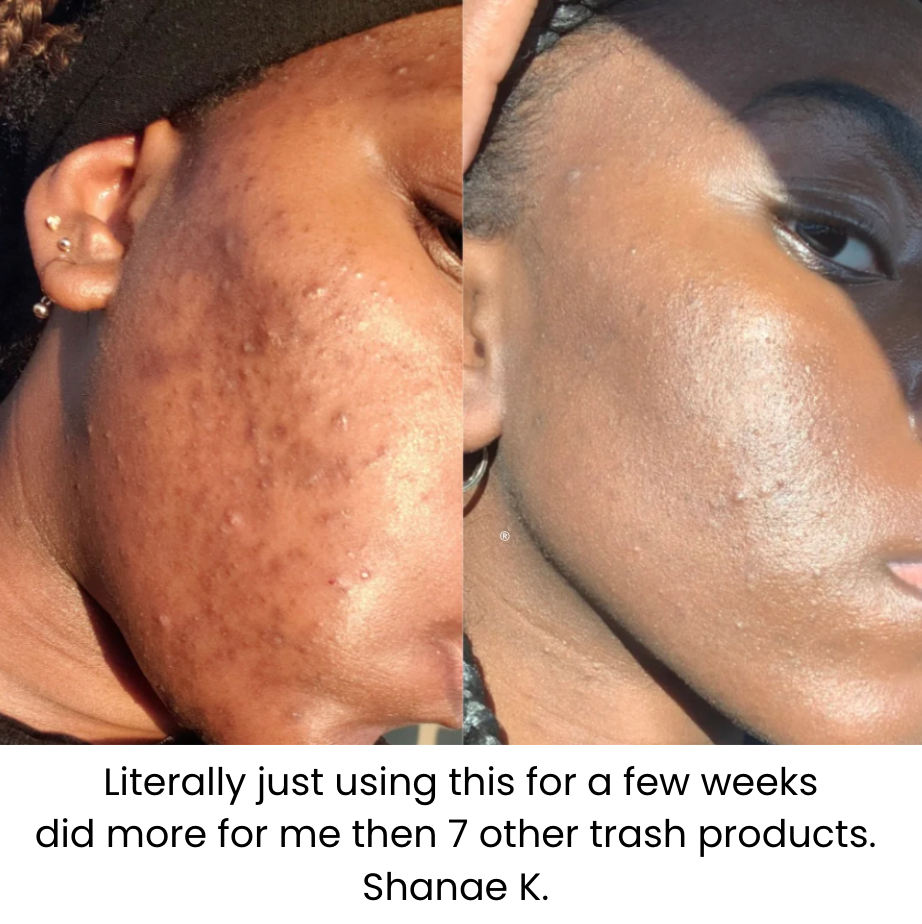 Kojic Acid Turmeric Face Wash