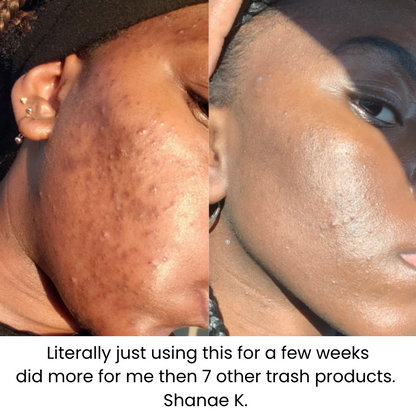 Kojic Acid Turmeric Face Wash