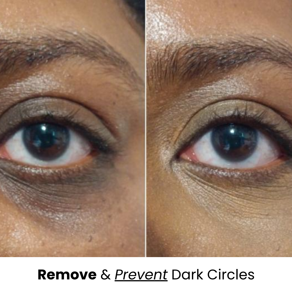 Turmeric Brightening Eye Patches