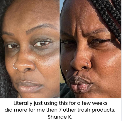 Turmeric Brightening Eye Patches