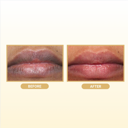All-Natural Turmeric Lip Balm