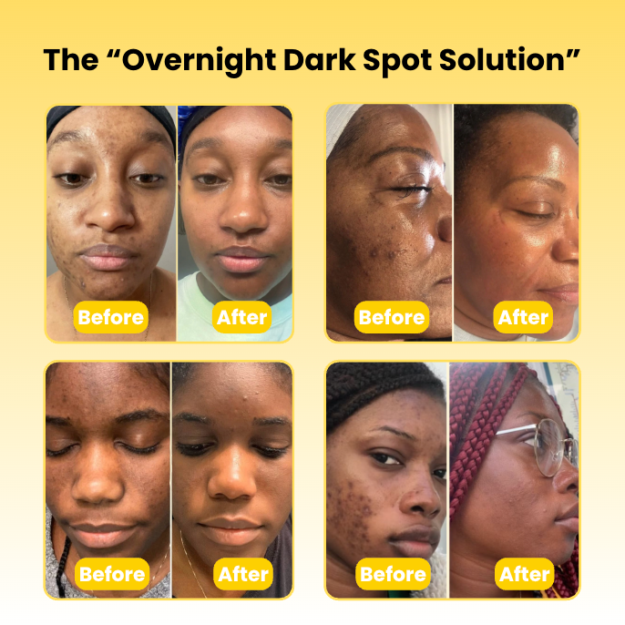 Kojic Acid Turmeric Overnight Mask