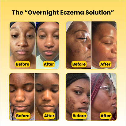 Kojic Acid Turmeric Overnight Mask
