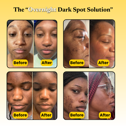 Kojic Acid Turmeric Overnight Mask