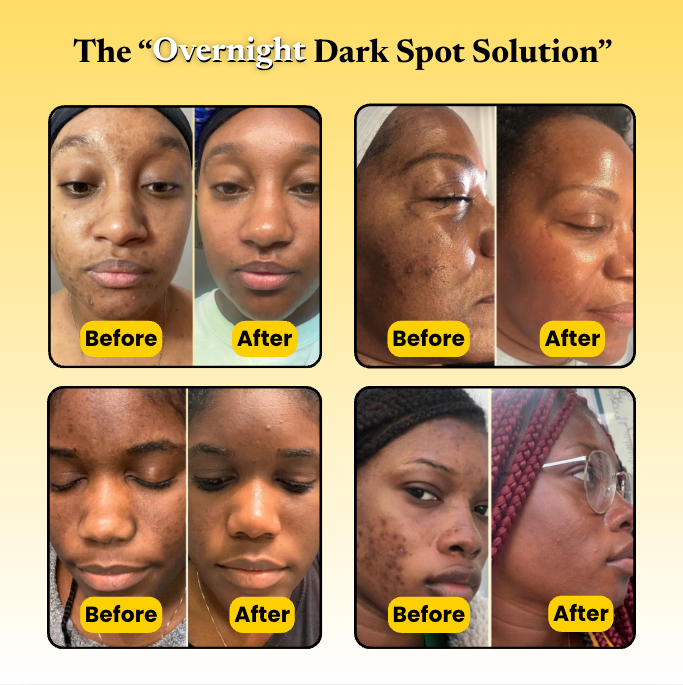Kojic Acid Turmeric Overnight Mask