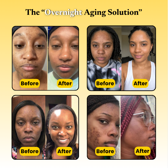 Kojic Acid Turmeric Overnight Mask For Reverse Aging