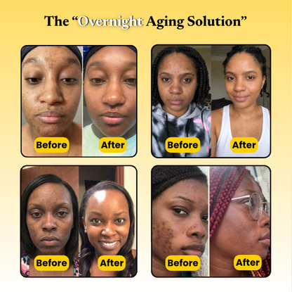 Kojic Acid Turmeric Overnight Mask For Reverse Aging