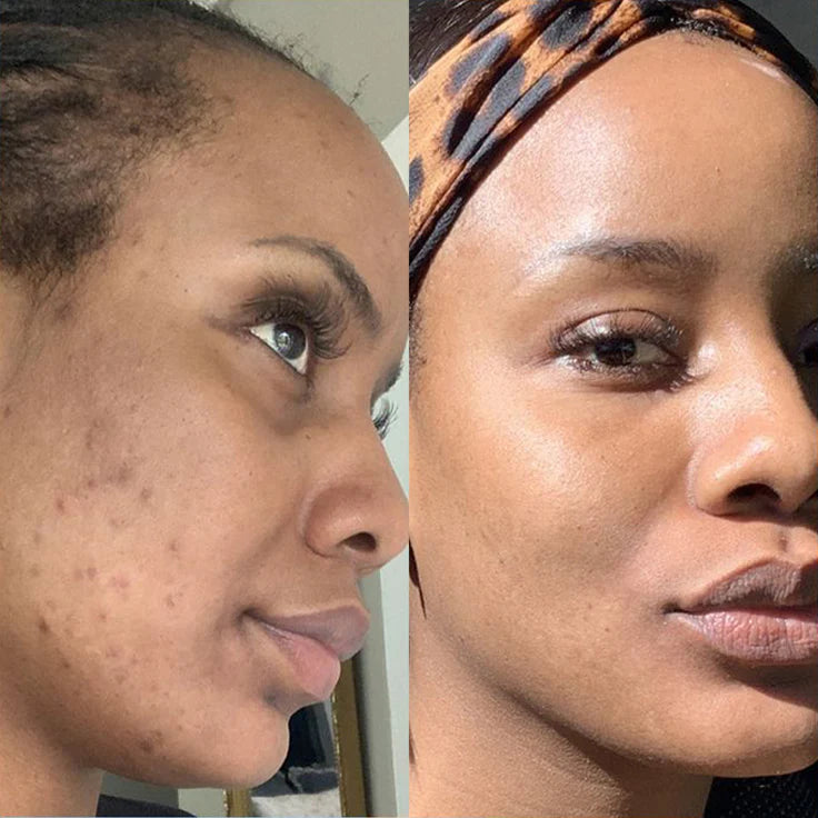 Kojic Acid Turmeric Overnight Mask